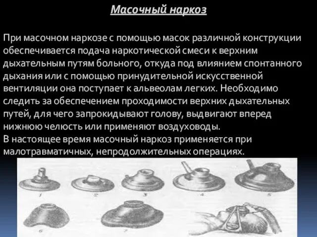 Масочный наркоз При масочном наркозе с помощью масок различной конструкции обеспе­чивается