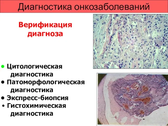 Диагностика онкозаболеваний Цитологическая диагностика Патоморфологическая диагностика Экспресс-биопсия Гистохимическая диагностика Верификация диагноза