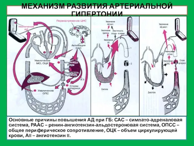 МЕХАНИЗМ РАЗВИТИЯ АРТЕРИАЛЬНОЙ ГИПЕРТОНИИ Основные причины повышения АД при ГБ: САС