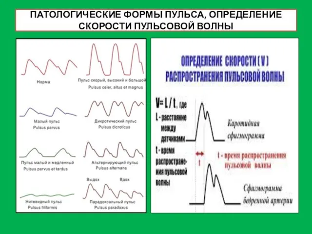 ПАТОЛОГИЧЕСКИЕ ФОРМЫ ПУЛЬСА, ОПРЕДЕЛЕНИЕ СКОРОСТИ ПУЛЬСОВОЙ ВОЛНЫ