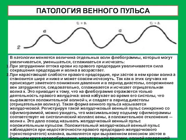 ПАТОЛОГИЯ ВЕННОГО ПУЛЬСА В патологии меняется величина отдельных волн флебограммы, которые