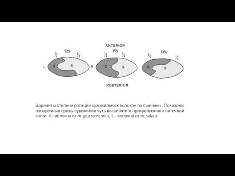 Варианты степени ротации сухожильных волокон по Cumminis . Показаны поперечные срезы
