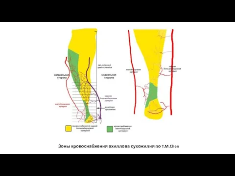 Зоны кровоснабжения ахиллова сухожилия по T.M.Chen