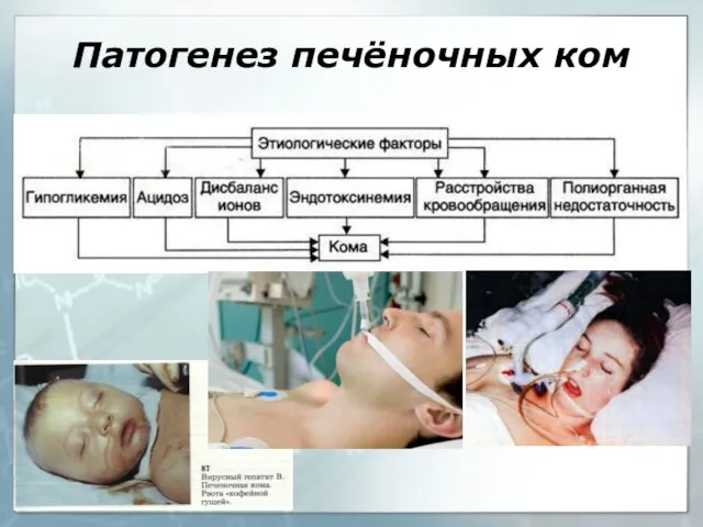 Патогенез печёночных ком