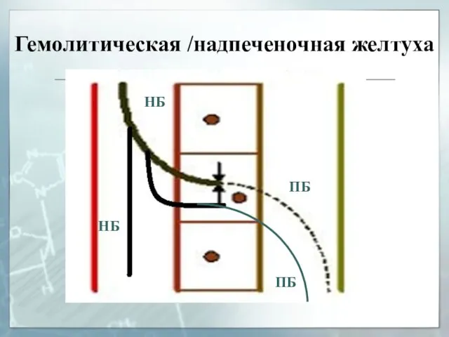 Гемолитическая /надпеченочная желтуха НБ НБ ПБ ПБ