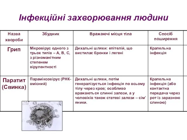 Інфекційні захворювання людини