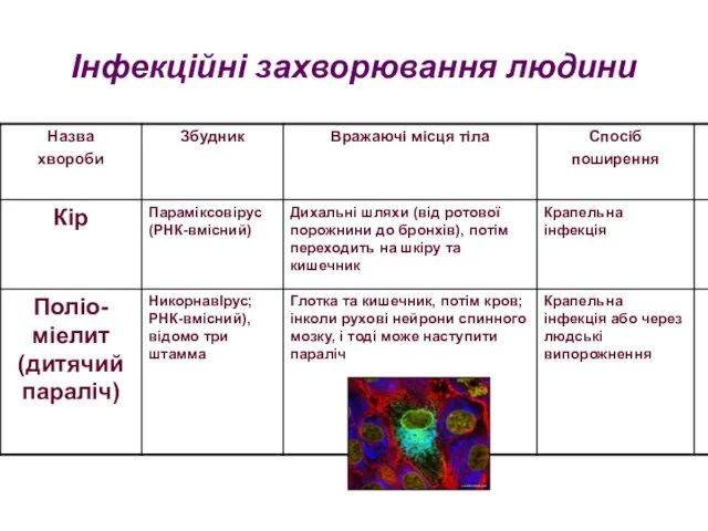 Інфекційні захворювання людини