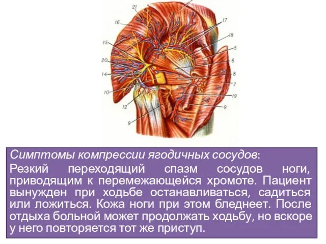 Симптомы компрессии ягодичных сосудов: Резкий переходящий спазм сосудов ноги, приводящим к