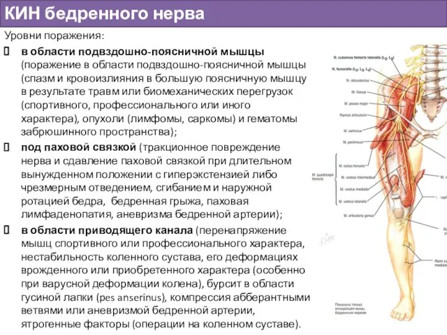 КИН бедренного нерва Уровни поражения: в области подвздошно-поясничной мышцы (поражение в