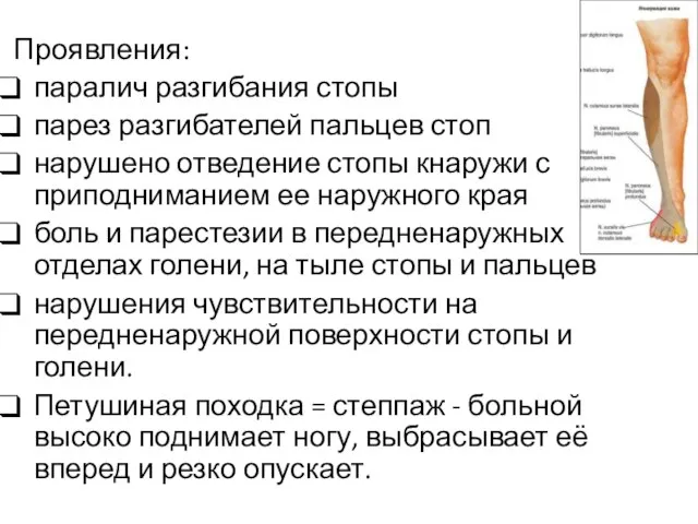 Проявления: паралич разгибания стопы парез разгибателей пальцев стоп нарушено отведение стопы