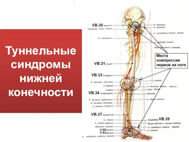 Туннельные синдромы нижней конечности