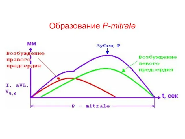 Образование P-mitrale