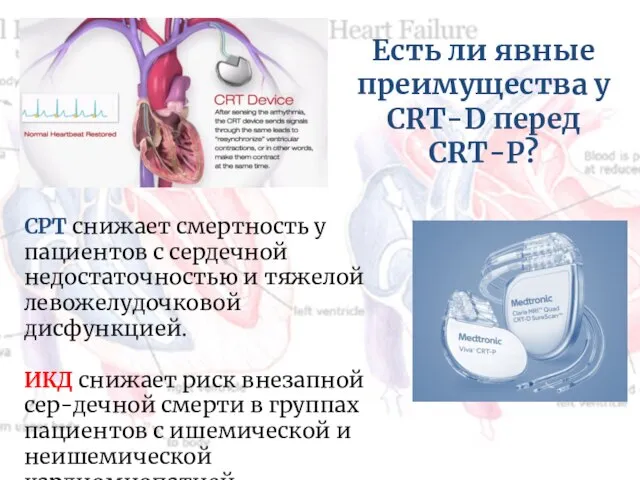 Есть ли явные преимущества у CRT-D перед СRT-P? СРТ снижает смертность