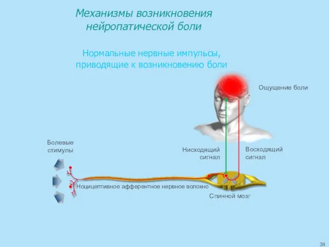 Механизмы возникновения нейропатической боли Нормальные нервные импульсы, приводящие к возникновению боли