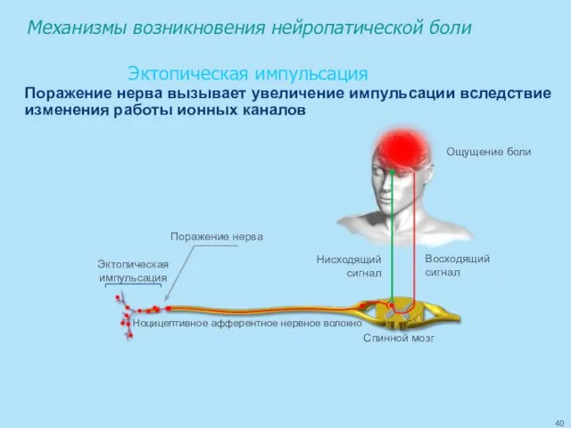 Ноцицептивное афферентное нервное волокно Спинной мозг Восходящий сигнал Нисходящий сигнал Ощущение