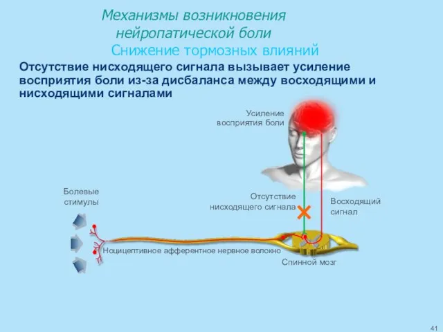 Механизмы возникновения нейропатической боли Снижение тормозных влияний Восходящий сигнал Отсутствие нисходящего