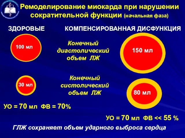 Ремоделирование миокарда при нарушении сократительной функции (начальная фаза) ЗДОРОВЫЕ КОМПЕНСИРОВАННАЯ ДИСФУНКЦИЯ
