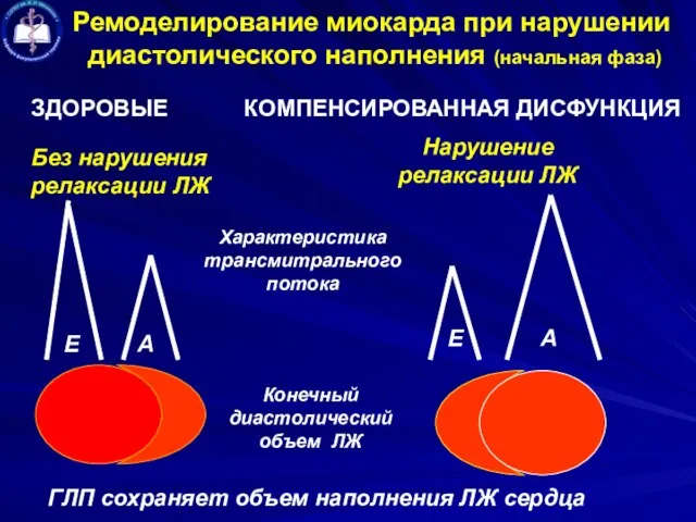 Ремоделирование миокарда при нарушении диастолического наполнения (начальная фаза) ЗДОРОВЫЕ КОМПЕНСИРОВАННАЯ ДИСФУНКЦИЯ