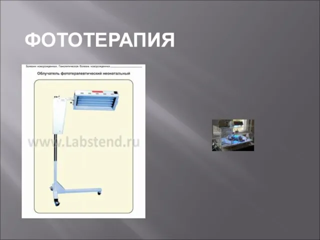 ФОТОТЕРАПИЯ