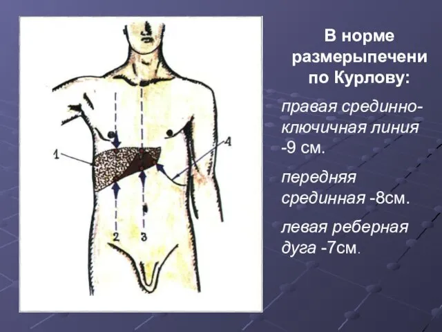 В норме размерыпечени по Курлову: правая срединно-ключичная линия -9 см. передняя