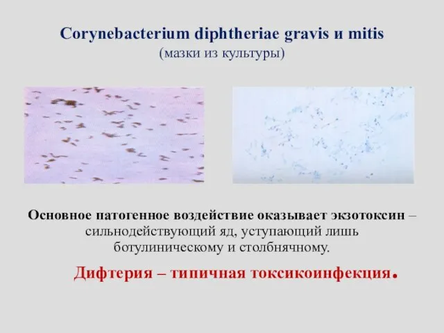 Corynebacterium diphtheriae gravis и mitis (мазки из культуры) Основное патогенное воздействие