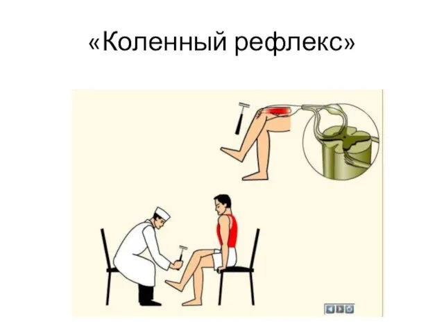 «Коленный рефлекс»