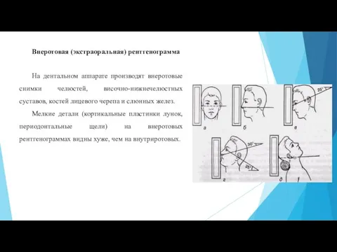 Внеротовая (экстраоральная) рентгенограмма На дентальном аппарате производят внеротовые снимки челюстей, височно-нижнечелюстных