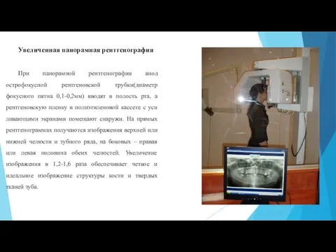 Увеличенная панорамная рентгенография При панорамной рентгенографии анод острофокусной рентгеновской трубки(диаметр фокусного