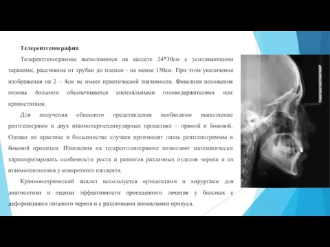 Телерентгенография Телерентгенограммы выполняются на кассете 24*30см с усиливающими экранами, расстояние от