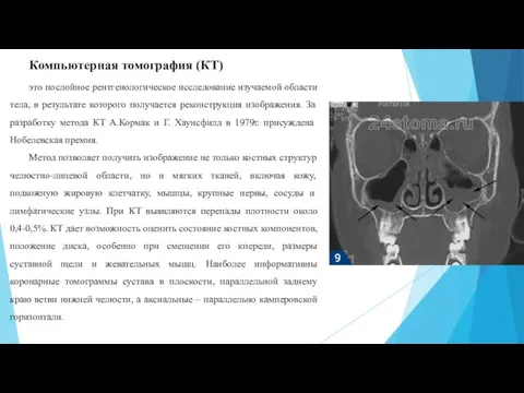 Компьютерная томография (КТ) это послойное рентгенологическое исследование изучаемой области тела, в