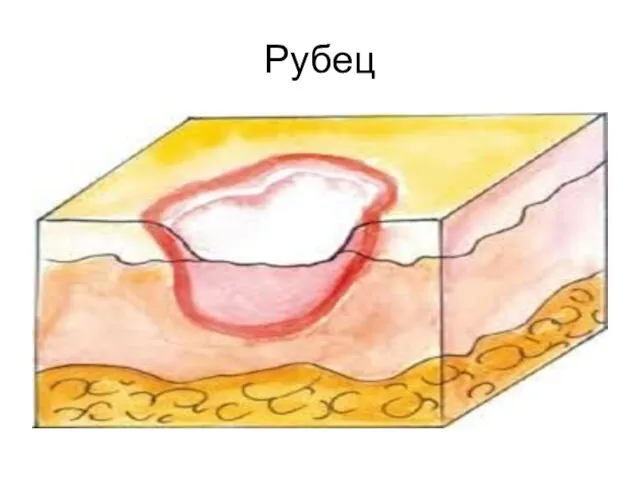 Рубец