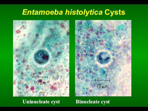 Entamoeba histolytica Cysts Uninucleate cyst Binucleate cyst