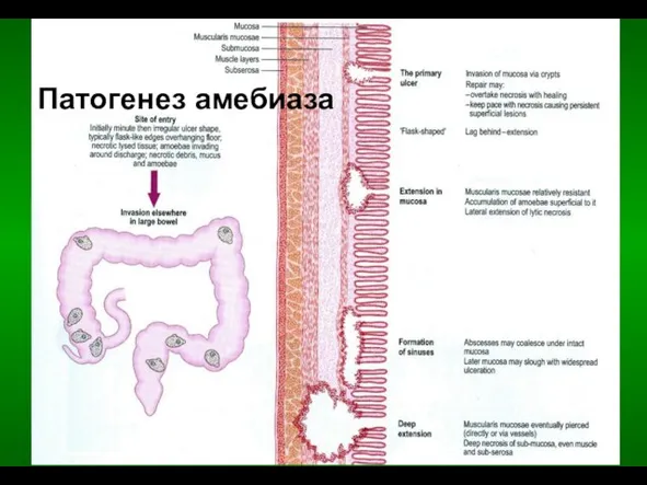 Патогенез амебиаза