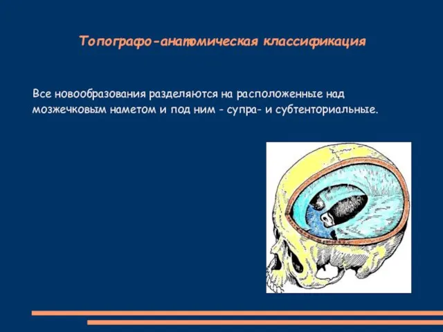 Топографо-анатомическая классификация Все новообразования разделяются на расположенные над мозжечковым наметом и