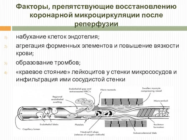 Факторы, препятствующие восстановлению коронарной микроциркуляции после реперфузии набухание клеток эндотелия; агрегация