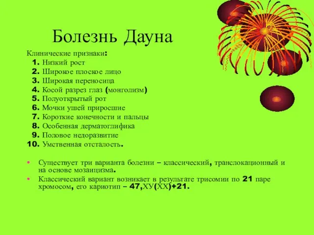 Болезнь Дауна Клинические признаки: 1. Низкий рост 2. Широкое плоское лицо