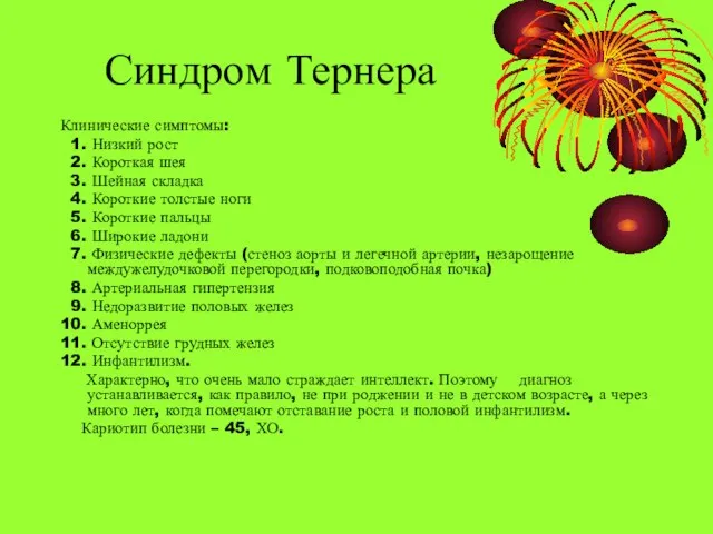 Синдром Тернера Клинические симптомы: 1. Низкий рост 2. Короткая шея 3.