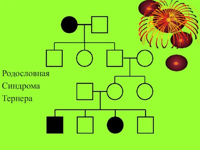 Родословная Синдрома Тернера