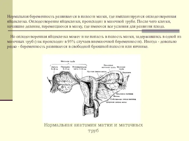 Нормальная беременность развивается в полости матки, где имплантируется оплодотворенная яйцеклетка. Оплодотворение