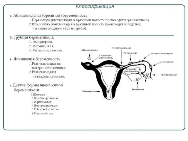 Классификация а. Абдоминальная (брюшная) беременность 1.Первичную (имплантация в брюшной полости происходит