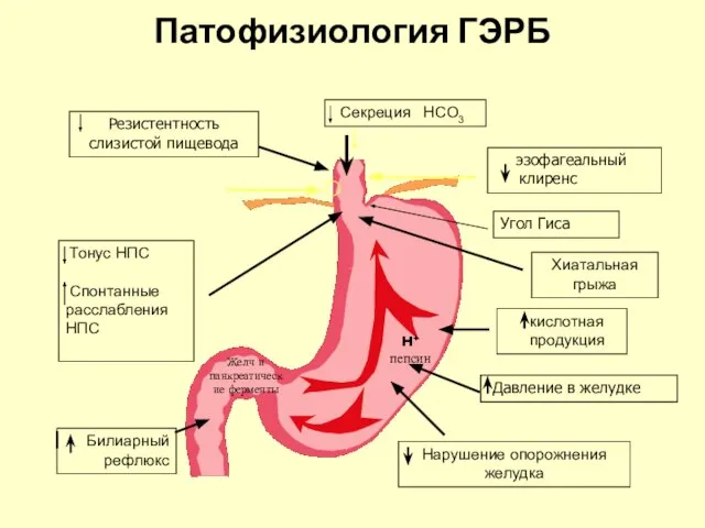 Патофизиология ГЭРБ Резистентность слизистой пищевода Секреция HCO3 Хиатальная грыжа Тонус НПС