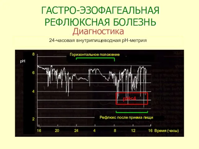 ГАСТРО-ЭЗОФАГЕАЛЬНАЯ РЕФЛЮКСНАЯ БОЛЕЗНЬ Диагностика 24-часовая внутрипищеводная рН-метрия Горизонтальное положение 8 6