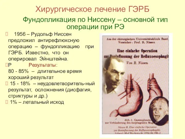 1956 – Рудольф Ниссен предложил антирефлюксную операцию – фундопликацию при ГЭРБ.