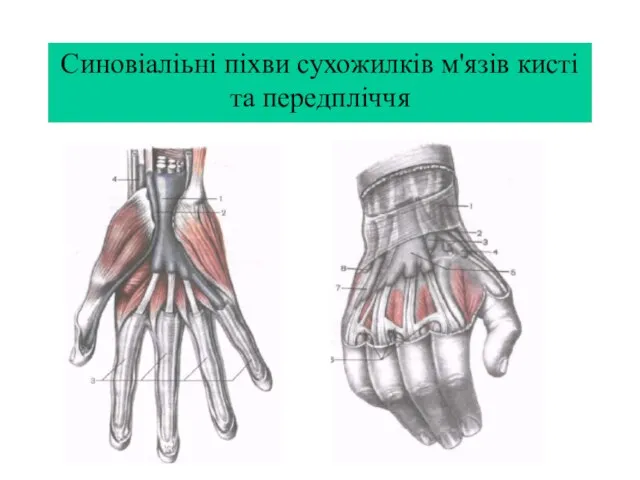 Синовіаліьні піхви сухожилків м'язів кисті та передпліччя