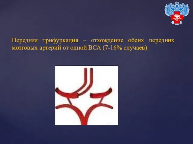 Передняя трифуркация – отхождение обеих передних мозговых артерий от одной ВСА (7-16% случаев)