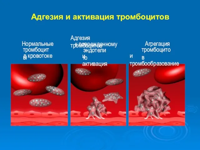 Адгезия и активация тромбоцитов Нормальные тромбоциты в кровотоке Агрегация тромбоцитов и
