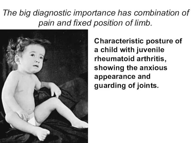 The big diagnostic importance has combination of pain and fixed position