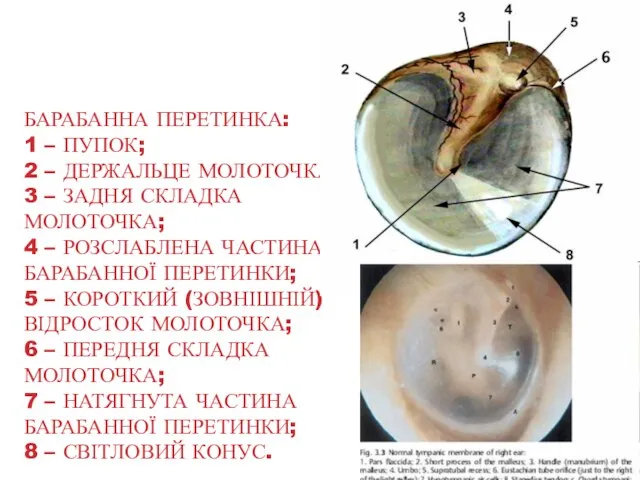 БАРАБАННА ПЕРЕТИНКА: 1 – ПУПОК; 2 – ДЕРЖАЛЬЦЕ МОЛОТОЧКА; 3 –