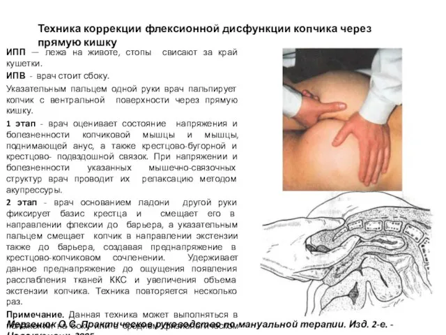 ИПП — лежа на животе, стопы свисают за край кушетки. ИПВ