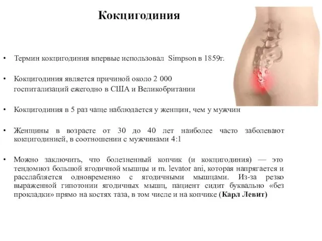 Термин кокцигодиния впервые использовал Simpson в 1859г. Кокцигодиния является причиной около